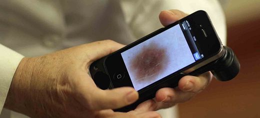 Greek researchers created support system for the early diagnosis of malignant melanoma