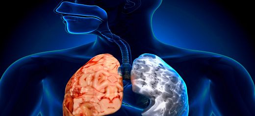 Greek scientist sheds light at the genetic backround of COPD