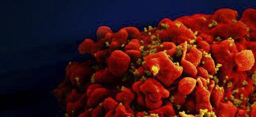 Ελληνίδα πίσω από νέα μέθοδο που ξετρυπώνει κρυμμένα μολυσμένα κύτταρα του ιού HIV