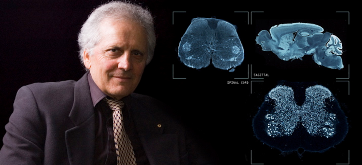 The man who mapped the human brain