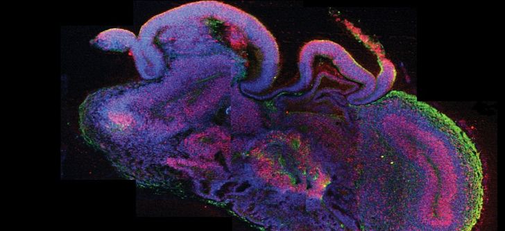 Δημιούργησαν μίνι – εγκεφάλους για τη μελέτη νευρολογικών ασθενειών