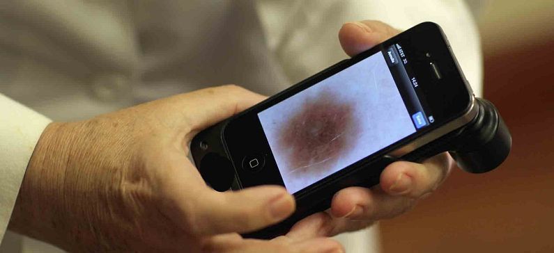 Greek researchers created support system for the early diagnosis of malignant melanoma